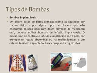 Tipos de Bombas
• Bombas Implantáveis :
• Em alguns casos de dores crônicas (como as causadas por
trauma físico e por alguns tipos de câncer), que não
encontram solução nem com doses elevadas de medicação
oral, pode-se utilizar bombas de infusão implantáveis. O
mecanismo de controle e infusão é implantado sob a pele, por
exemplo na região abdominal ou na região lombar, e um
cateter, também implantado, leva a droga até a região alvo.
 