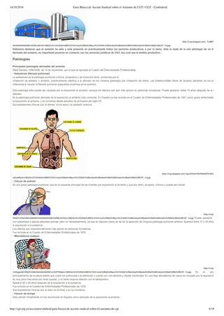 14/10/2016 Guía Básica de Acción Sindical sobre el Amianto de CGT | CGT - Confederal
http://cgt.org.es/secciones/sindical/guia-basica-de-accion-sindical-sobre-el-amianto-de-cgt 6/18
(http://2.bp.blogspot.com/-_Fy06fZWTP4/VNH6
3liI/AAAAAAAAASE/22rDWvJ0imA/s1600/Gu%C3%ADa%2BB%C3%A1sica%2Bde%2Bacci%C3%B3n%2Bsindical%2Bsobre%2Bel%2BAmianto%2Bde%2Bla%2BCGT_10.jpg)
Debemos destacar que el amianto ha sido y está presente en prácticamente todos los sectores productivos, y por lo tanto, ante la duda de si una patología de un trabajador
derivada del amianto, es importante ponerse en contacto con los servicios jurídicos de CGT, sea cual sea el ámbito productivo.
Patologias
Principales patologías derivadas del amianto
(Real Decreto 1299/2006, de 10 de noviembre, por el que se aprueba el Cuadro de Enfermedades Profesionales)
- Asbestosis (ﬁbrosis pulmonar)
La asbestosis es la patología pulmonar crónica, progresiva y de evolución lenta, producida por la
inhalación de asbesto o amianto, prácticamente idéntica a la silicosis de los mineros (patología por inhalación de sílice). Las indestructibles ﬁbras de amianto penetran en los pulmones y
inﬂamarse el causan la ﬁbrosis pulmonar (pequeñas cicatrices en el pulmón).
Esta patología sólo puede ser causada por la exposición al amianto, aunque los efectos son aún más graves en personas fumadoras. Puede aparecer hasta 10 años después de la exposición
asbesto.
Es la patología pulmonar derivada de la exposición al amianto más conocida. En España ya fue incluida en el Cuadro de Enfermedades Profesionales de 1947 como grave enfermedad derivada
la exposición al amianto, y es conocida desde estudios de principios del siglo XX.
Sus expresiones clínicas son la disnea, la tos seca y la opresión torácica
(http://3.bp.blogspot.com/-KgLtH2Dd4TM/VNIASDFN-8I/AAAAAAAAAS
xzEye9iSo4/s1600/Gu%C3%ADa%2BB%C3%A1sica%2Bde%2Bacci%C3%B3n%2Bsindical%2Bsobre%2Bel%2BAmianto%2Bde%2Bla%2BCGT_12.jpg)
- Cáncer de pulmón
Es una grave patología pulmonar, que es la causante principal de las muertes por exposición al amianto y que por tanto, es grave, crónica y puede ser mortal.
(http://4.bp.blogspot.co
tthKEA1bTbk/VNIonSMGBOI/AAAAAAAAASE/ho939LDsTXw/s1600/Gu%C3%ADa%2BB%C3%A1sica%2Bde%2Bacci%C3%B3n%2Bsindical%2Bsobre%2Bel%2BAmianto%2Bde%2Bla%2BCGT_13.jpg) Puede aparecer en person
con asbestosis o placas pleurales previas, pero no necesariamente, ya que en algunos casos se da sin la aparición de ninguna patología pulmonar anterior. Aparece entre 15 y 40 años después
la exposición a la sustancia.
Los efectos son exponencialmente más graves en personas fumadoras.
Fue incluida en el Cuadro de Enfermedades Profesionales de 1978.
- Mesotelioma maligno
(http://4.bp.blogspot.co
vhJhjegwfaA/VNIo5Fx338I/AAAAAAAAASE/xxLSVPT8Qak/s1600/Gu%C3%ADa%2BB%C3%A1sica%2Bde%2Bacci%C3%B3n%2Bsindical%2Bsobre%2Bel%2BAmianto%2Bde%2Bla%2BCGT_14.jpg) Es un grave tum
principalmente de la pleura (tejido que cubre los pulmones) o el peritoneo y cuenta con una altísima y rápida mortandad. En una tasa elevadísima de casos es causado por la exposición al
es muy poco frecuente por otras causas, y no tiene ninguna relación con el tabaquismo.
Aparece 30 o 40 años después de la exposición a la sustancia.
Fue incluido en el Cuadro de Enfermedades Profesionales de 1978.
Sus expresiones clínicas son el dolor en el tórax o en los hombros.
- Cáncer de laringe
Este cáncer inicialmente no fue reconocido en España como derivado de la exposición al amianto.
 