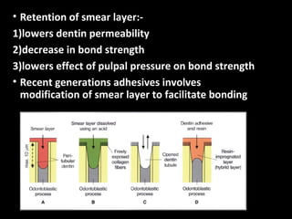 Smearing Adhesion Example Bond | PPT