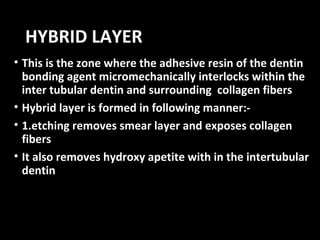 Bond | PPT