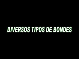 DIVERSOS TIPOS DE BONDES 