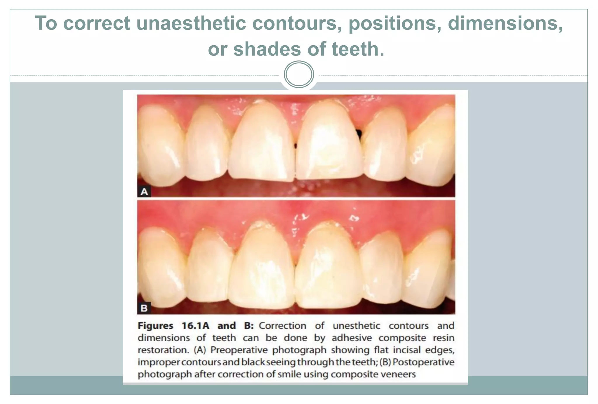Adhesion and Dentin Bonding agent | PDF