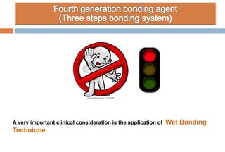 A very important clinical consideration is the application of Wet Bonding
Technique
 
