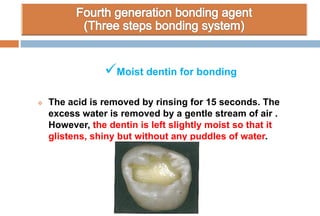 Moist dentin for bonding
 The acid is removed by rinsing for 15 seconds. The
excess water is removed by a gentle stream of air .
However, the dentin is left slightly moist so that it
glistens, shiny but without any puddles of water.
 