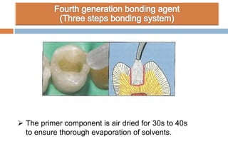  The primer component is air dried for 30s to 40s
to ensure thorough evaporation of solvents.
 