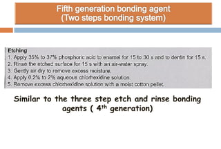 Similar to the three step etch and rinse bonding
agents ( 4th generation)
 