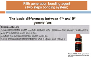 The basic differences between 4th and 5th
generations
 