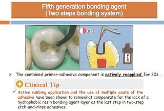  The combined primer-adhesive component is actively reapplied for 30s .
Active rubbing application and the use of multiple coats of the
adhesive have been shown to somewhat compensate for the lack of a
hydrophobic resin bonding agent layer as the last step in two-step
etch-and-rinse adhesives.
 