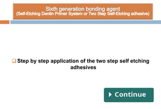 Step by step application of the two step self etching
adhesives
 