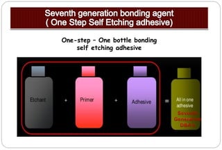 One-step – One bottle bonding
self etching adhesive
 