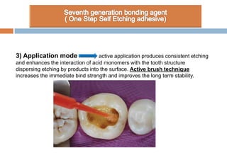 3) Application mode active application produces consistent etching
and enhances the interaction of acid monomers with the tooth structure
dispersing etching by products into the surface. Active brush technique
increases the immediate bind strength and improves the long term stability.
 