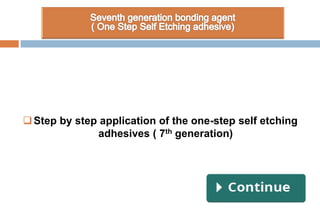 Step by step application of the one-step self etching
adhesives ( 7th generation)
 