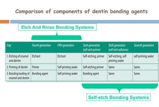Etch And Rinse Bonding Systems
Self-etch Bonding Systems
Comparison of components of dentin bonding agents
 