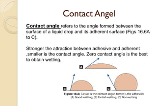 Contact Angel
Contact angle refers to the angle formed between the
surface of a liquid drop and its adherent surface (Figs 16.6A
to C).
Stronger the attraction between adhesive and adherent
,smaller is the contact angle. Zero contact angle is the best
to obtain wetting.
 