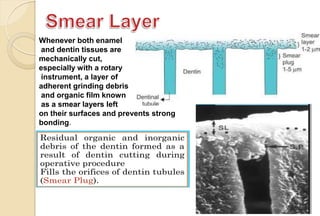 Whenever both enamel
and dentin tissues are
mechanically cut,
especially with a rotary
instrument, a layer of
adherent grinding debris
and organic film known
as a smear layers left
on their surfaces and prevents strong
bonding.
 