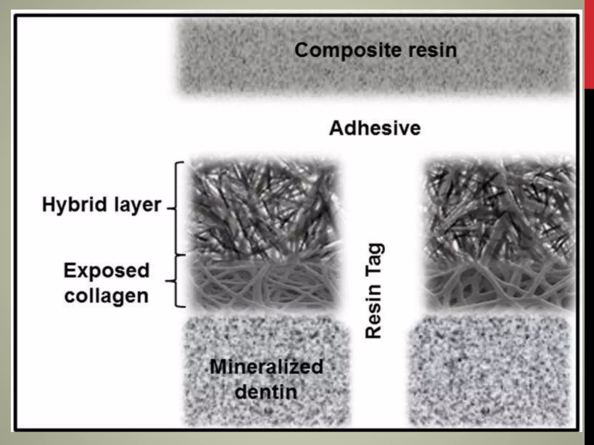 Dentin Bonding agents generations PPT