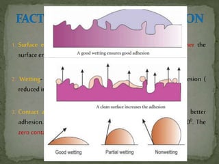 1. Surface energy- Generally, the harder the surface is the higher the
surface energy willbe and so better willbe the adhesion.
2. Wetting- High surface energy , better wetting and better adhesion (
reduced irregularities ).
3. Contact angle- Lower the contact angle, better wetting and better
adhesion. For good adhesion, the contact angle should be < 900. The
zero contactangle is the best to obtain wetting.
11
 