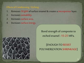 Effects of Conditioning / Etching:
1. Removes 10 µM of surface enamel & creates amicroporous layer.
2. Increases wettability.
3. Increases surface area.
4. Increases surface energy.
Bond strengthof composite to
etched enamel: 15-25 MPa.
[ENOUGH TO RESIST
POLYMERIZATION SHRINKAGE]
15
 