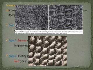 Micromorphologic Patterns of etching of Enamel
A properly etched enamel surface gives a frosty white appearance on
drying.
Type1–Most common.
Preferential removal of enamel prism cores & periphery intact.
Type2-Reverse of type 1.
Periphery removed andcores intact.
Type3–Etching pattern less distinct.
Both types 1 & 2 present.
22
 