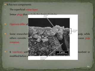  It hastwocomponents:
1. Thesuperficialsmear layer.
2. Smear plugsthatoccludethedentinaltubules.
 Opinionsdifferaboutthesmear layer.
 Some researchers consider it a natural protective liner for the pulp, while
others consider it as a source of microorganisms which can cause pulp
irritation.
 It interferes with adhesion, and so it should be removed, dissolved or
modifiedbeforeapplyingdentinbondingagents.
62
 