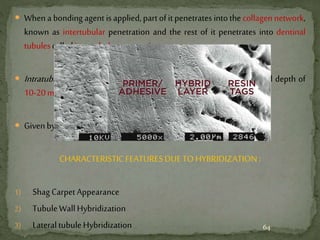  Whenabonding agentis applied,partofitpenetrates intothe collagennetwork,
known as intertubular penetration and the rest of it penetrates into dentinal
tubulescalledintratubularpenetration.
 Intratubular penetration or the formation of resin tags upto a limited depth of
10-20microns.
 GivenbyNakabayashiin1982.
CHARACTERISTICFEATURESDUETO HYBRIDIZATION :
1) ShagCarpetAppearance
2) TubuleWallHybridization
3) Lateral tubuleHybridization 64
 