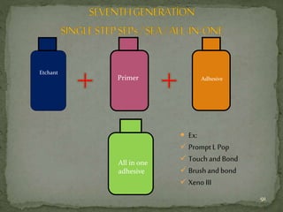  Ex:
 Prompt LPop
 Touch andBond
 Brushand bond
 Xeno III
Etchant
Primer Adhesive
All in one
adhesive
91
 