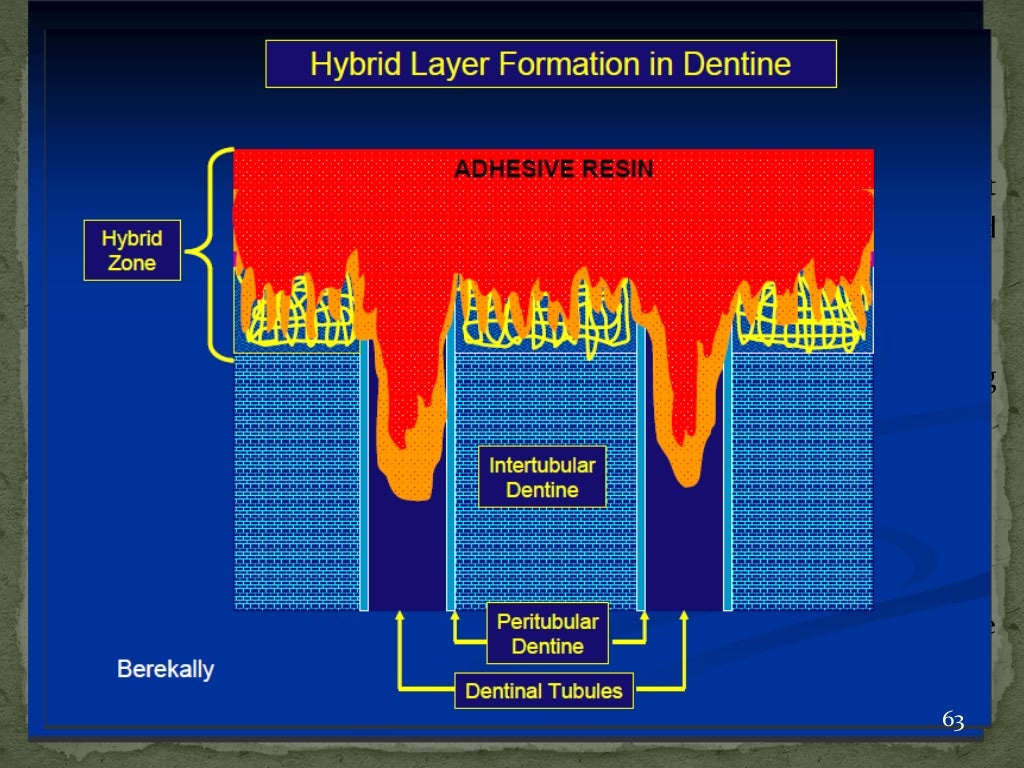 Bonding agents used in dentistry