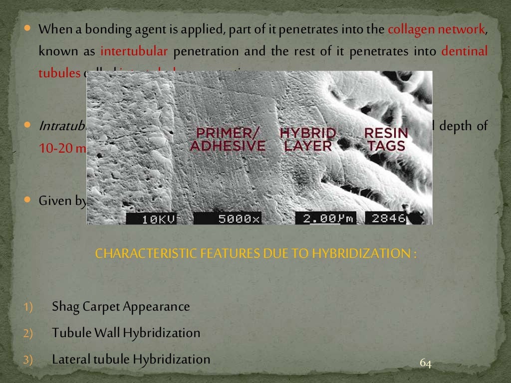 Bonding agents used in dentistry