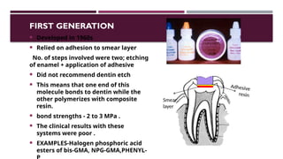 Smearing Adhesion Example Bonding Agents used in Conservative dentistry and endodontics.pptx