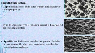 BONDING AGENTS :fundamentals in bonding and adhesion | PPTX