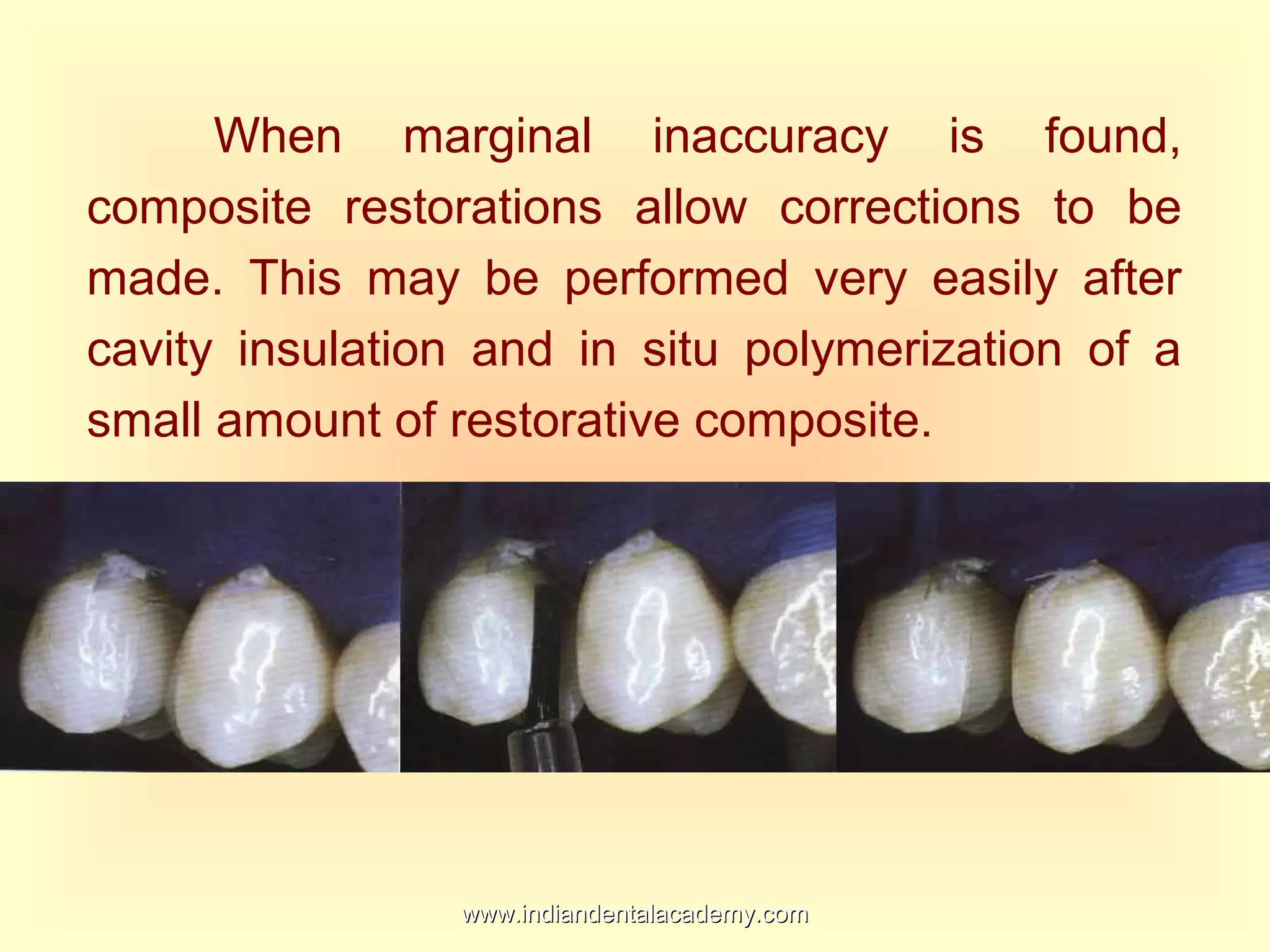 When marginal inaccuracy is found,
composite restorations allow corrections to be
made. This may be performed very easily after
cavity insulation and in situ polymerization of a
small amount of restorative composite.
www.indiandentalacademy.comwww.indiandentalacademy.com
 