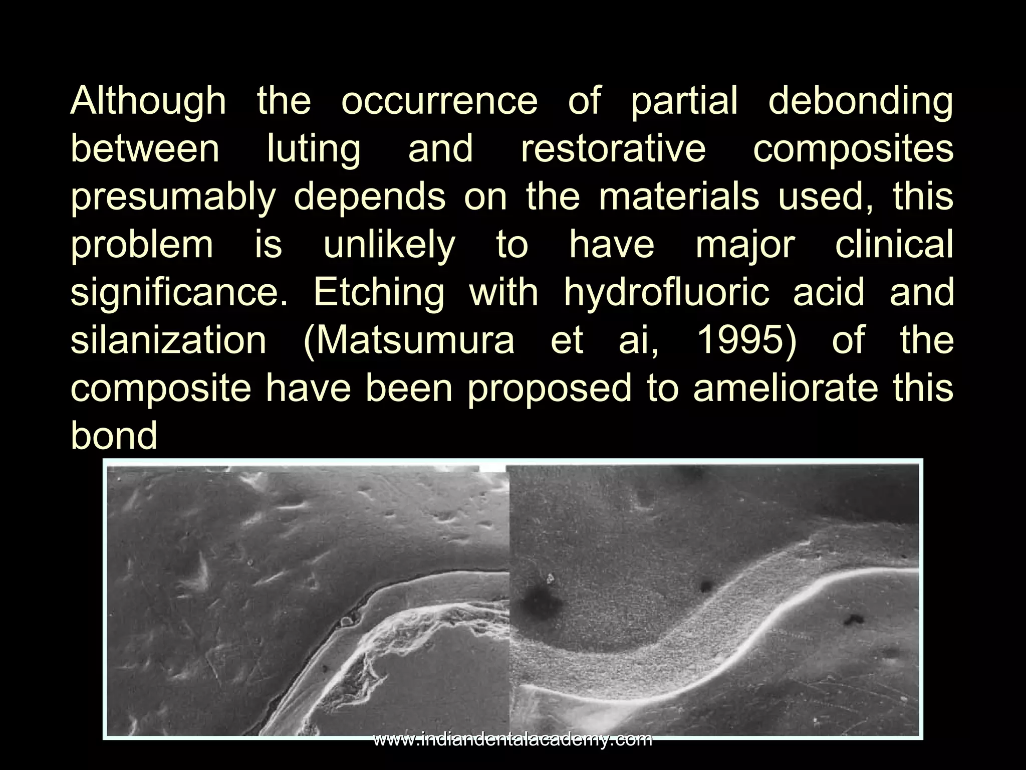 Although the occurrence of partial debonding
between luting and restorative composites
presumably depends on the materials used, this
problem is unlikely to have major clinical
significance. Etching with hydrofluoric acidhydrofluoric acid and
silanizationsilanization (Matsumura et ai, 1995) of the
composite have been proposed to ameliorate this
bond
www.indiandentalacademy.comwww.indiandentalacademy.com
 