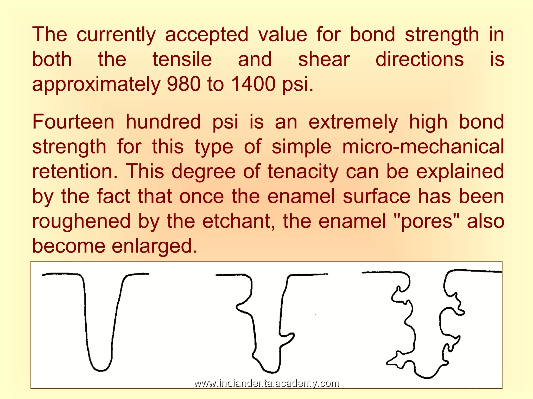The currently accepted value for bond strength in
both the tensile and shear directions is
approximately 980 to 1400 psi.
Fourteen hundred psi is an extremely high bond
strength for this type of simple micro-mechanical
retention. This degree of tenacity can be explained
by the fact that once the enamel surface has been
roughened by the etchant, the enamel "pores" also
become enlarged.
www.indiandentalacademy.comwww.indiandentalacademy.com
 