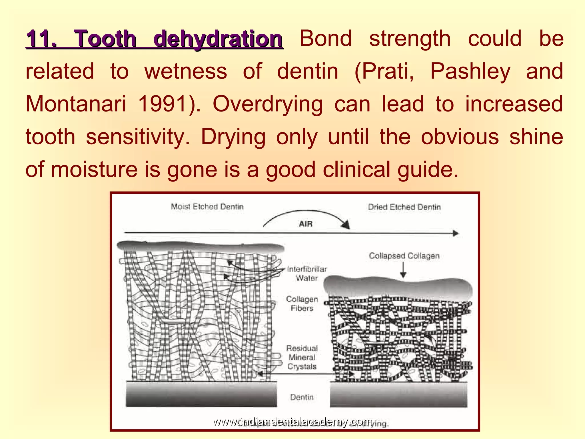 11. Tooth dehydration11. Tooth dehydration Bond strength could be
related to wetness of dentin (Prati, Pashley and
Montanari 1991). Overdrying can lead to increased
tooth sensitivity. Drying only until the obvious shine
of moisture is gone is a good clinical guide.
www.indiandentalacademy.comwww.indiandentalacademy.com
 