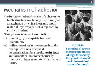 Mechanism of adhesion
the fundamental mechanism of adhesion to
tooth structure can be regarded simply as
an exchange by which inorganic tooth
material (hydroxyapatite) is replaced by
synthetic resins.
This process involves two parts:
(1) removing hydroxapatite to create
micropores.
(2) infiltration of resin monomers into the
micropores and subsequent
polymerization. As a result, resin tags
are formed that micromechanically
interlock or interpenetrate with the hard
tissue.
FIGURE :
Scanning electron
microscopy image
of tags formed by
the penetration of
resin into etched
areas of enamel.
5
drarifur_rahman@yahoo.com
 