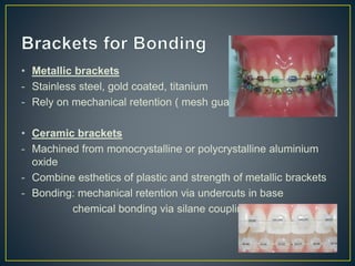 • Metallic brackets
- Stainless steel, gold coated, titanium
- Rely on mechanical retention ( mesh guaze)
• Ceramic brackets
- Machined from monocrystalline or polycrystalline aluminium
oxide
- Combine esthetics of plastic and strength of metallic brackets
- Bonding: mechanical retention via undercuts in base
chemical bonding via silane coupling agent
 