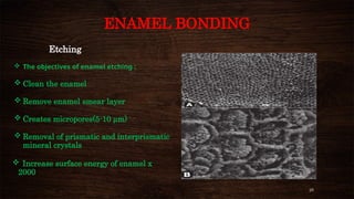 25
ENAMEL BONDING
Etching
 The objectives of enamel etching :
 Clean the enamel
 Remove enamel smear layer
 Creates micropores(5-10 µm)
 Removal of prismatic and interprismatic
mineral crystals
 Increase surface energy of enamel x
2000
 