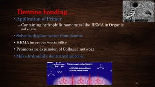 32
Dentine bonding….
• Application of Primer
– Containing hydrophilic monomers like HEMA in Organic
solvents
• Solvents displace water from dentine
• HEMA improves wettability
• Promotes re-expansion of Collagen network
• Make hydrophilic dentin hydrophobic
 