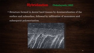 35
Hybridization (Nakabayashi,1982)
• Structure formed in dental hard tissues by demineralization of the
surface and subsurface, followed by infiltration of monomers and
subsequent polymerization.
 