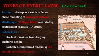 36
ZONES OF HYBRID LAYER (Perdiago 1996)
Top layer : Amorphous electron dense
phase consisting of denatured collagen.
Middle layer : Collagen fibrils separated by
electrolucent spaces of 10- 20 nm.
Bottom layer :
Gradual transition to underlying
unaltered dentin
partially demineralized containing HA
crystals enveloped by resin.
 