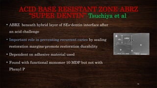 78
ACID BASE RESISTANT ZONE-ABRZ
“SUPER DENTIN” Tsuchiya et al
• ABRZ beneath hybrid layer of SEs-dentin interface after
an acid challenge
• Important role in preventing recurrent caries by sealing
restoration margins-promote restoration durability
• Dependent on adhesive material used
• Found with functional monomer 10 MDP but not with
Phenyl P
 