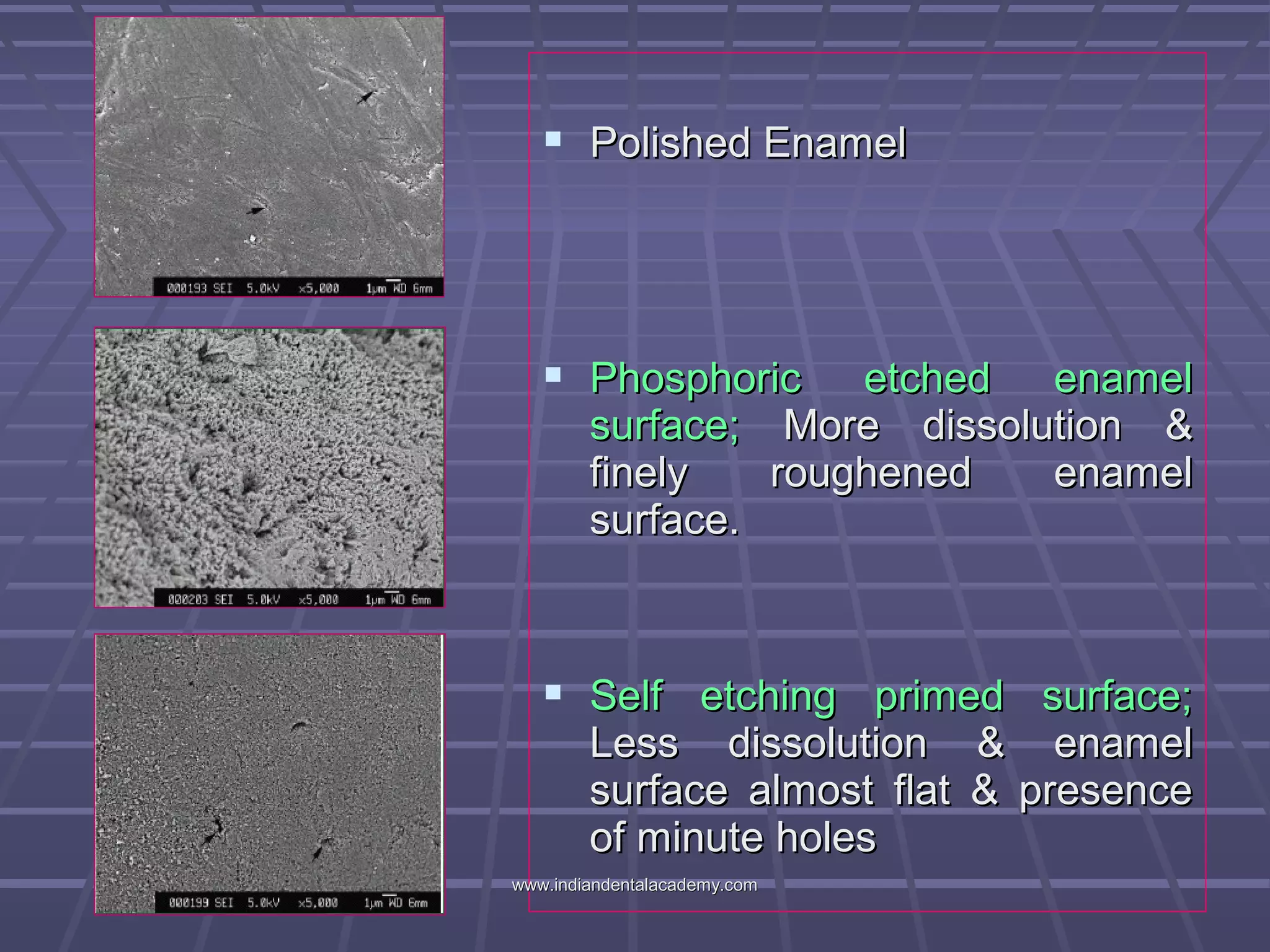  Polished EnamelPolished Enamel
 Phosphoric etched enamelPhosphoric etched enamel
surface;surface; More dissolution &More dissolution &
finely roughened enamelfinely roughened enamel
surface.surface.
 Self etching primed surface;Self etching primed surface;
Less dissolution & enamelLess dissolution & enamel
surface almost flat & presencesurface almost flat & presence
of minute holesof minute holes
www.indiandentalacademy.comwww.indiandentalacademy.com
 