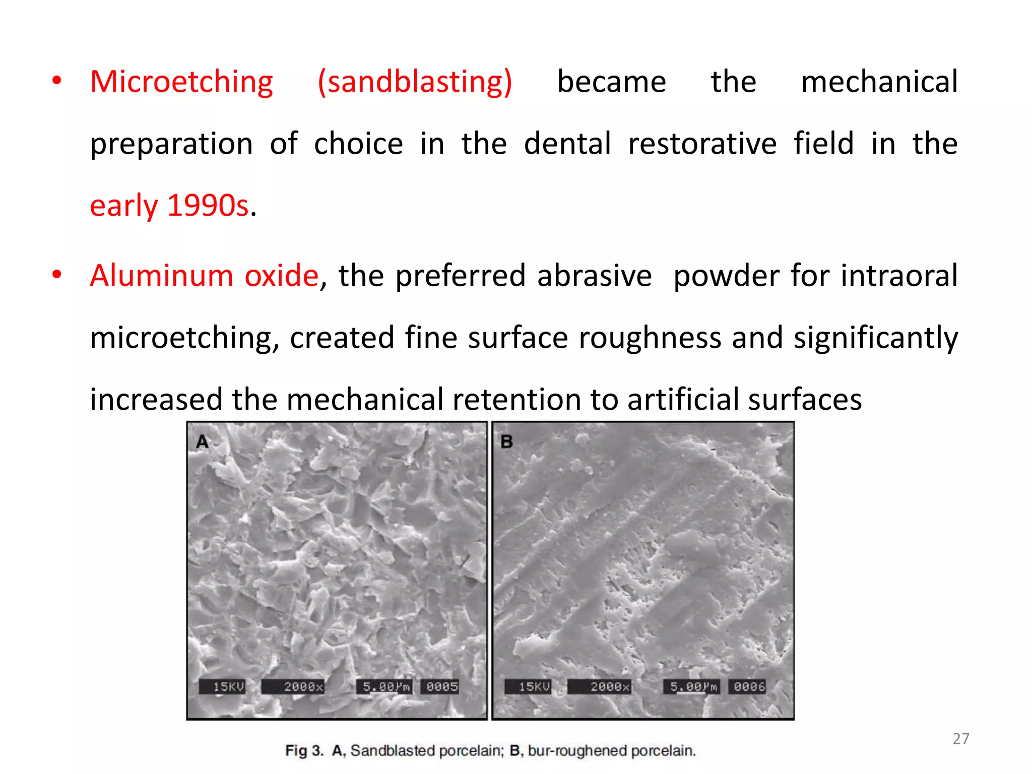 Bonding in Orthodontics | PPTX