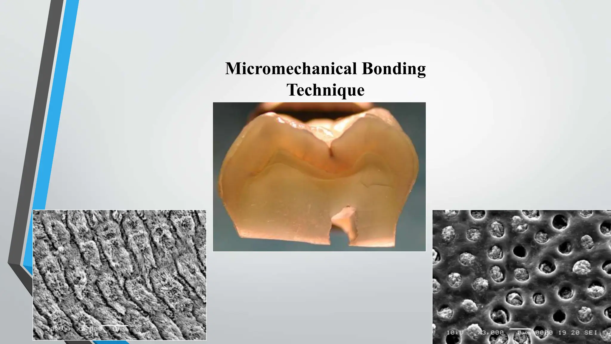 Micromechanical Bonding
Technique
 