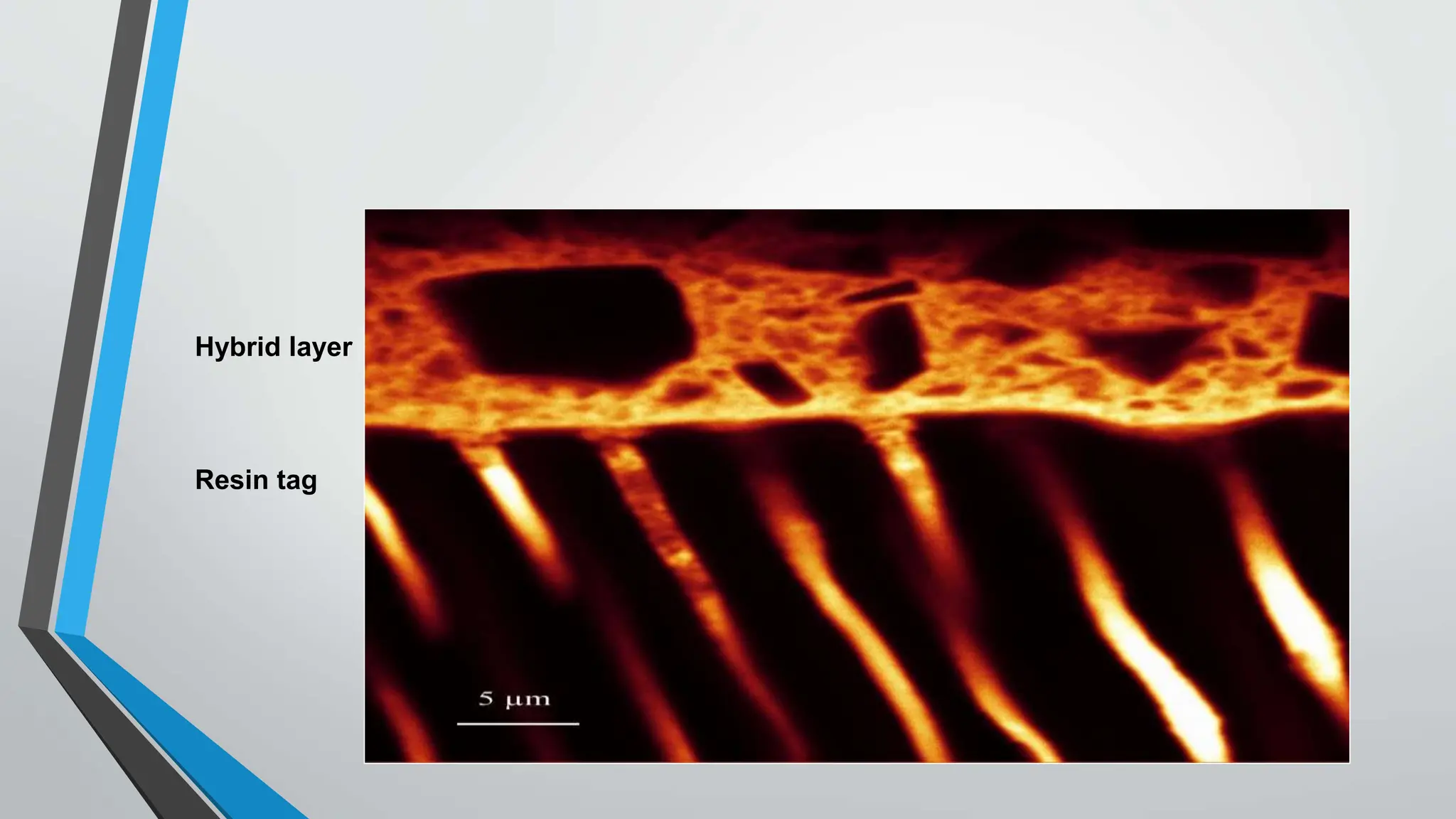 Hybrid layer
Resin tag
 
