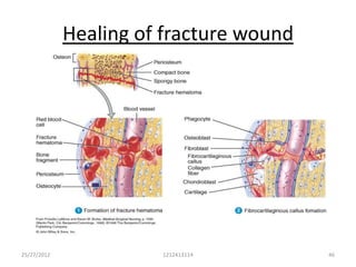 Healing of fracture wound




25/27/2012             1212413114        46
 