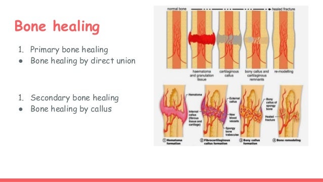 Bone