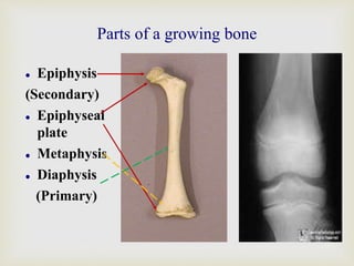 Parts of a growing bone
 Epiphysis
(Secondary)
 Epiphyseal
plate
 Metaphysis
 Diaphysis
(Primary)
 