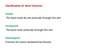 Classification of Bone Fractures
Simple
The bone ends do not protrude through the skin
Compound
The bone ends protrude through the skin
Pathological
Fracture of a bone weakened by disease.
 
