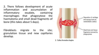 2. There follows development of acute
inflammation and accumulation of
inflammatory exudate, containing
macrophages that phagocytose the
haematoma and small dead fragments of
bone (this takes about 5 days).
Fibroblasts migrate to the site;
granulation tissue and new capillaries
develop.
 